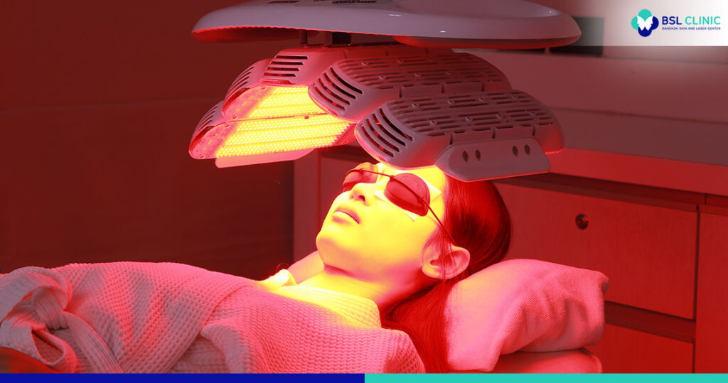 Acne Scarring and Blemish Treatment