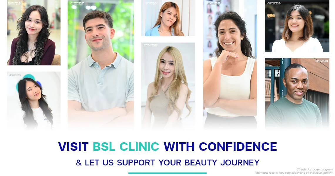 acne-treatment-program