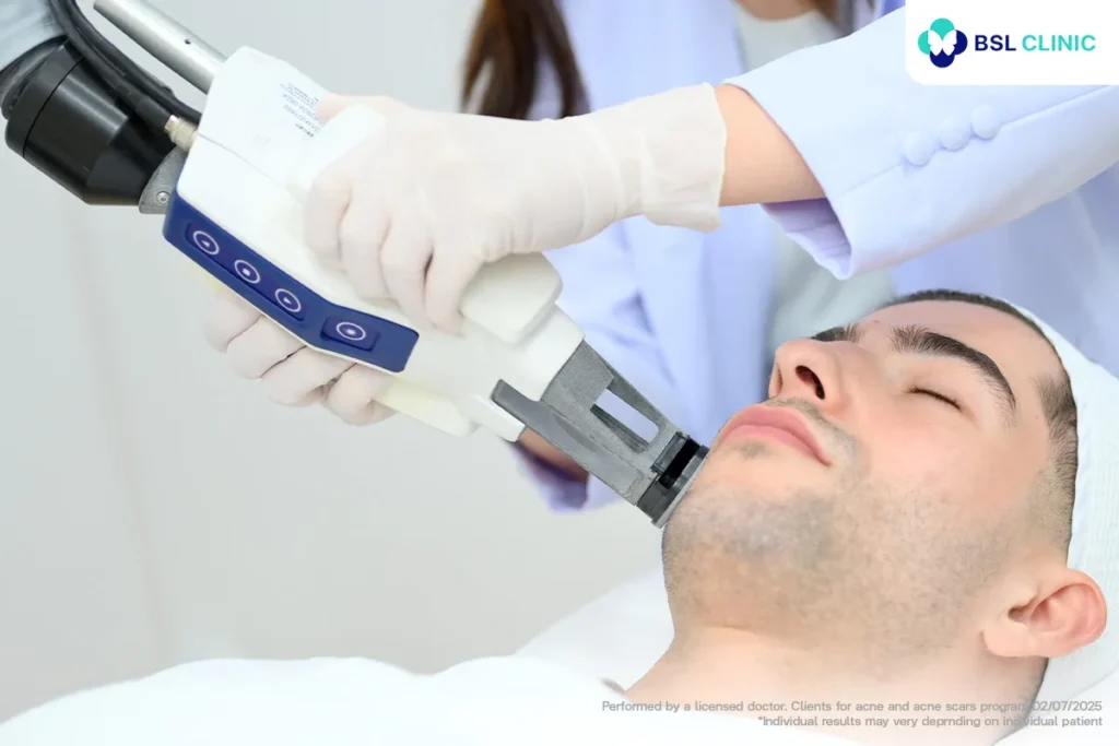 Acne laser treatment session at BSL Clinic Bangkok