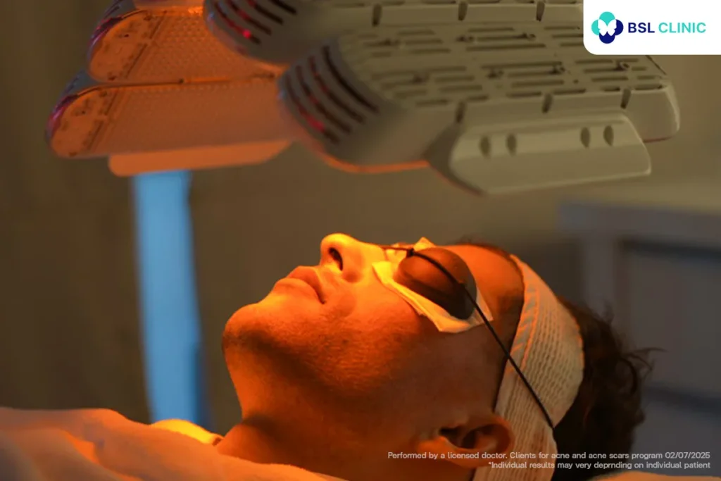 LED light therapy for acne treatment