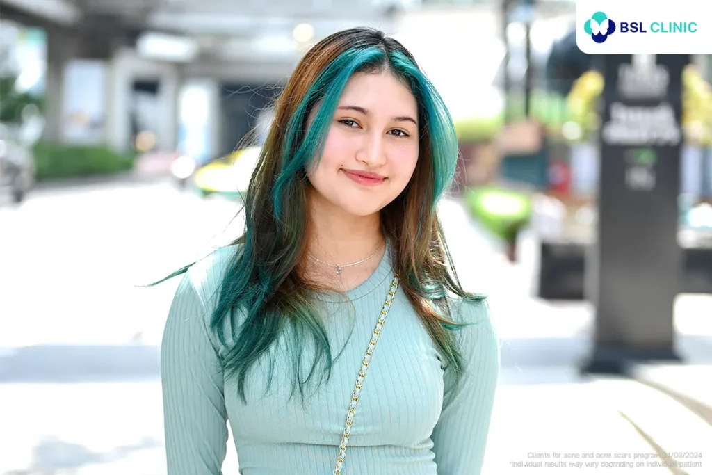 Acne treatment journey results at BSL Clinic Bangkok